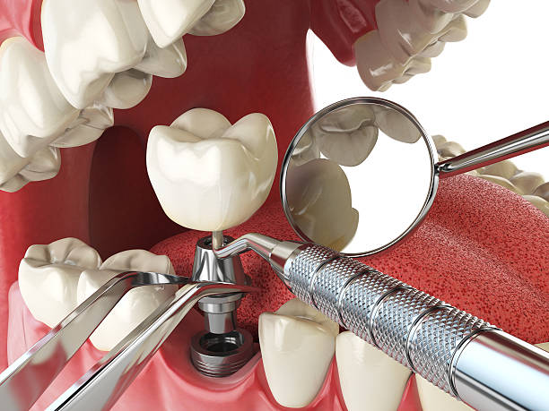 Best Mobile Emergency Dentist in Boiling Springs, SC